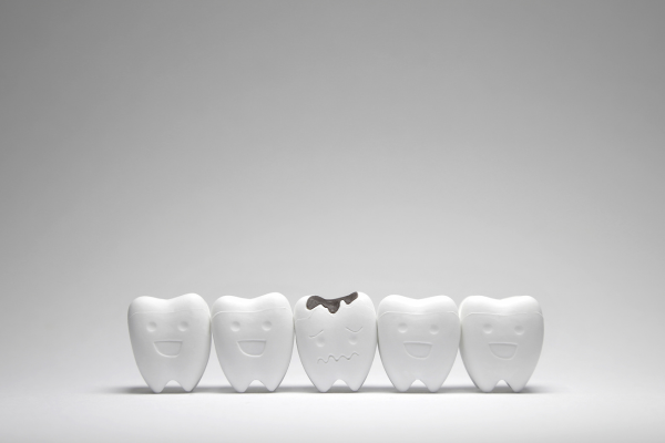 Best Way To Get Rid Of Silver Fillings
